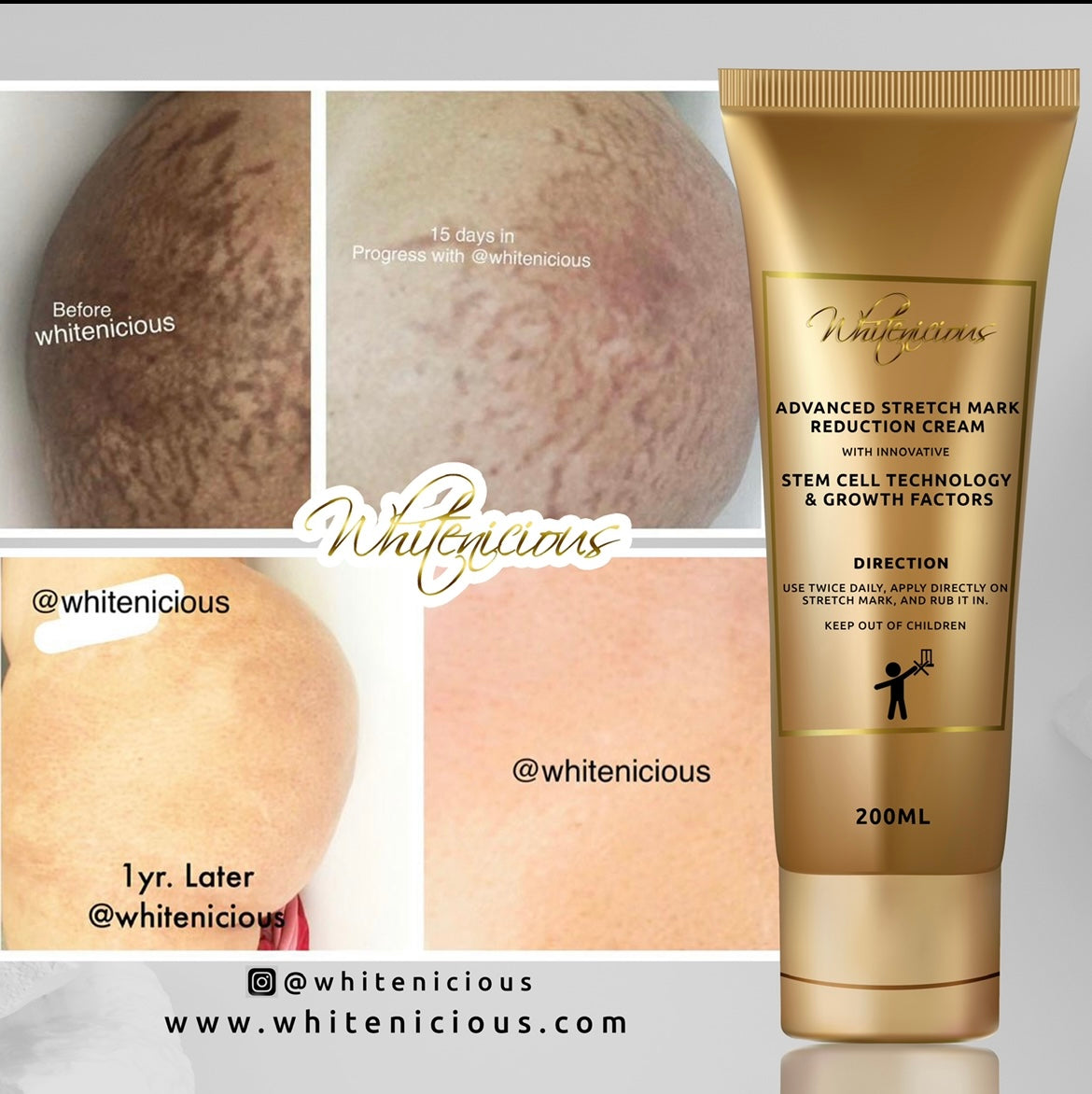 STRETCH MARK REPAIR