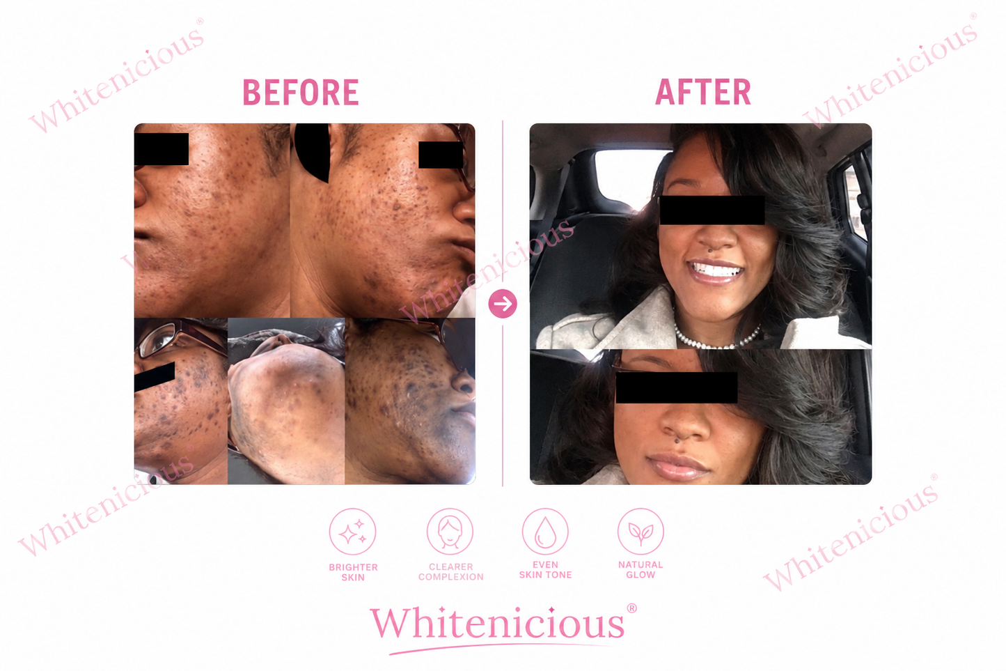 Angel Skin Creme