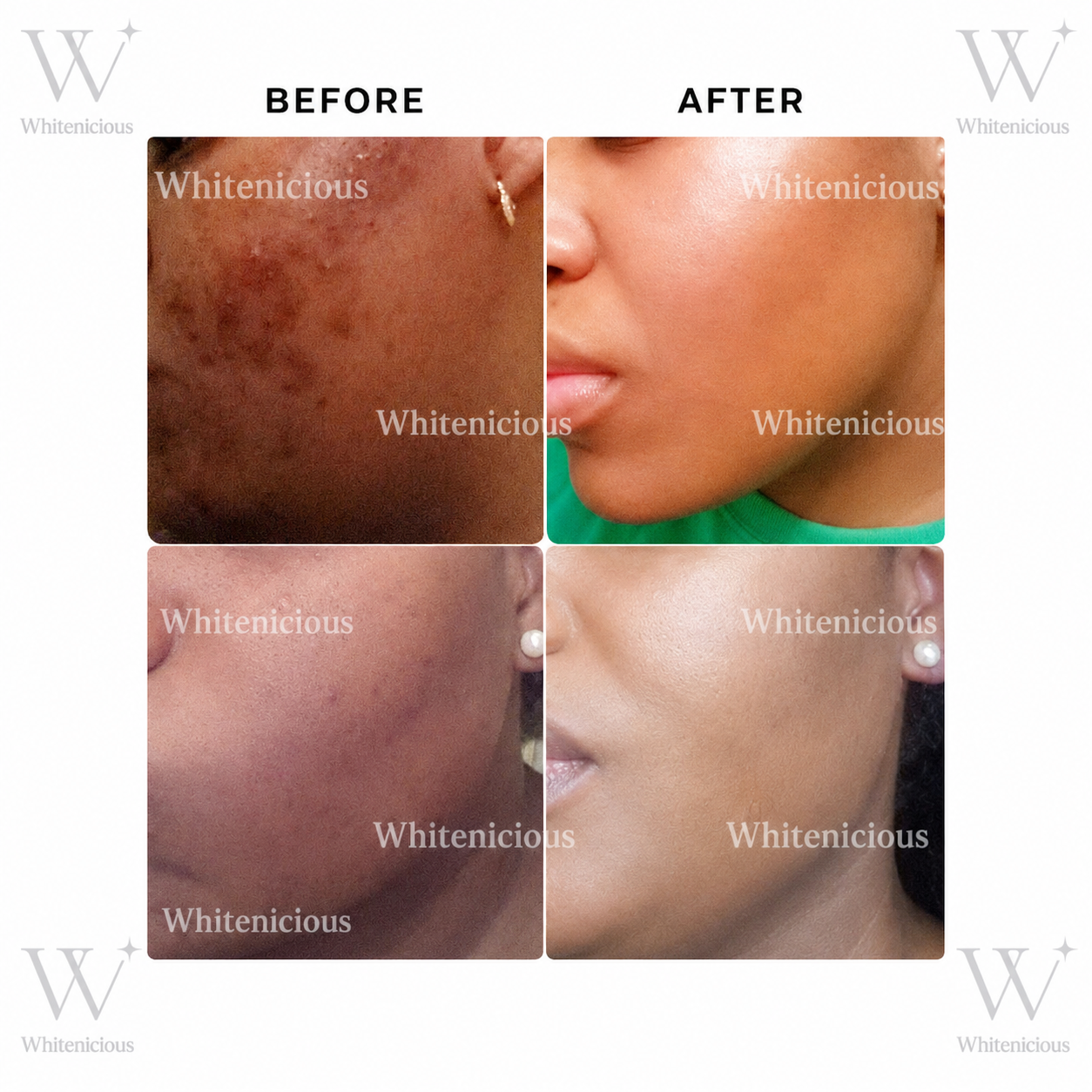 Angel Skin Creme