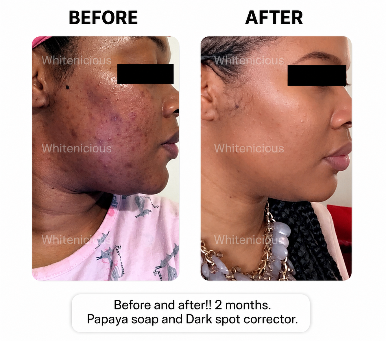 24k Gold Infused DarkSpot  Eraser Crème