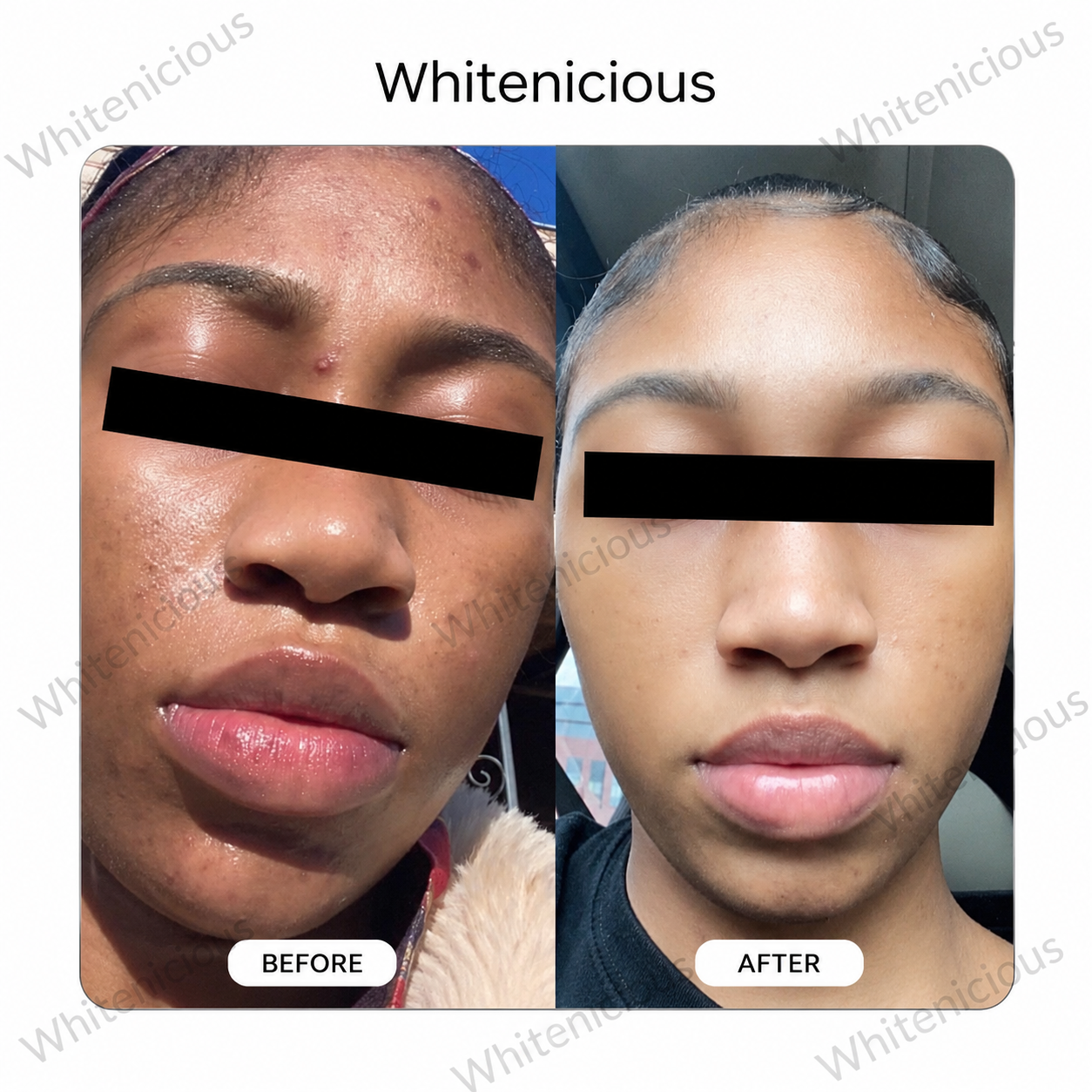 Angel Skin Creme
