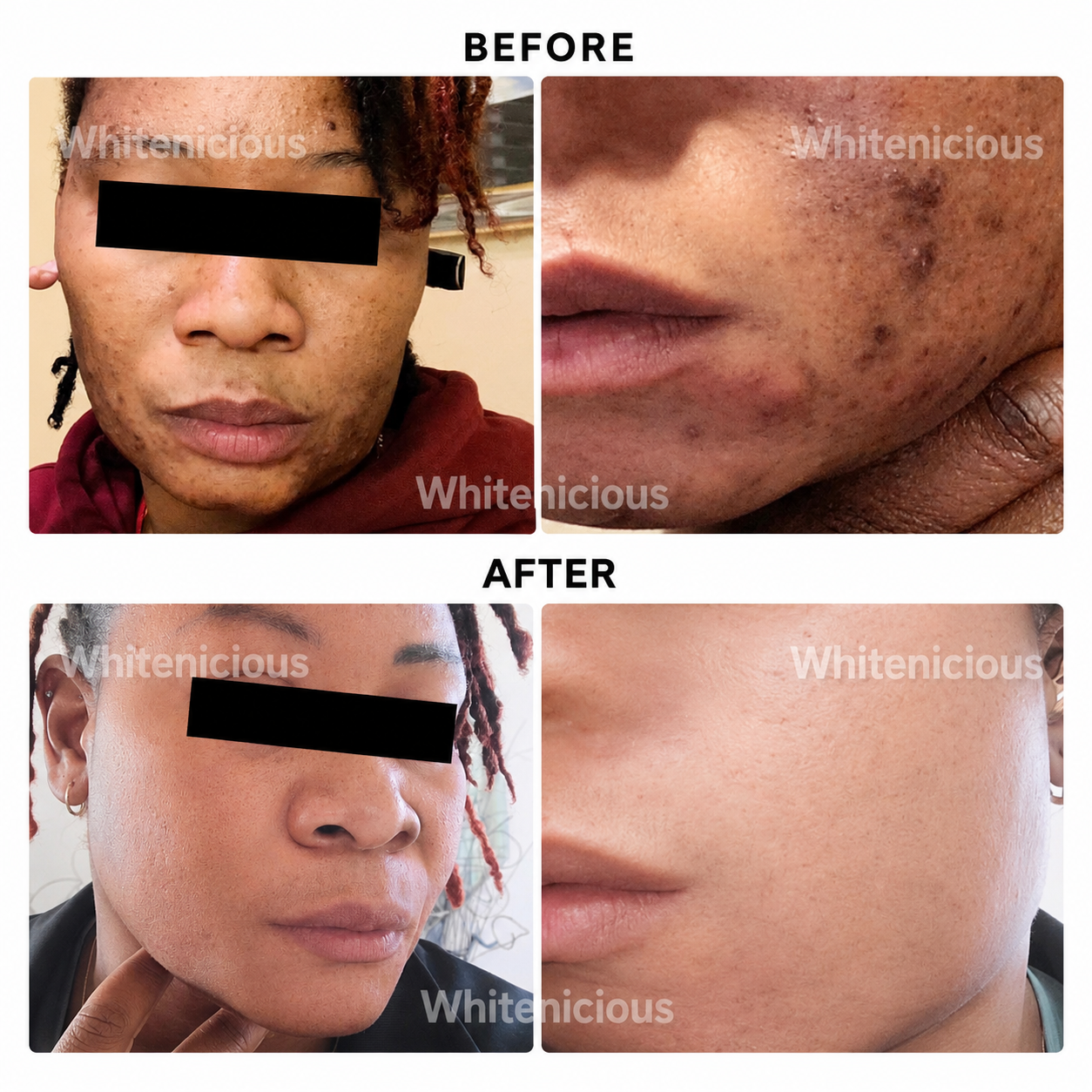 24k Gold Infused DarkSpot  Eraser Crème