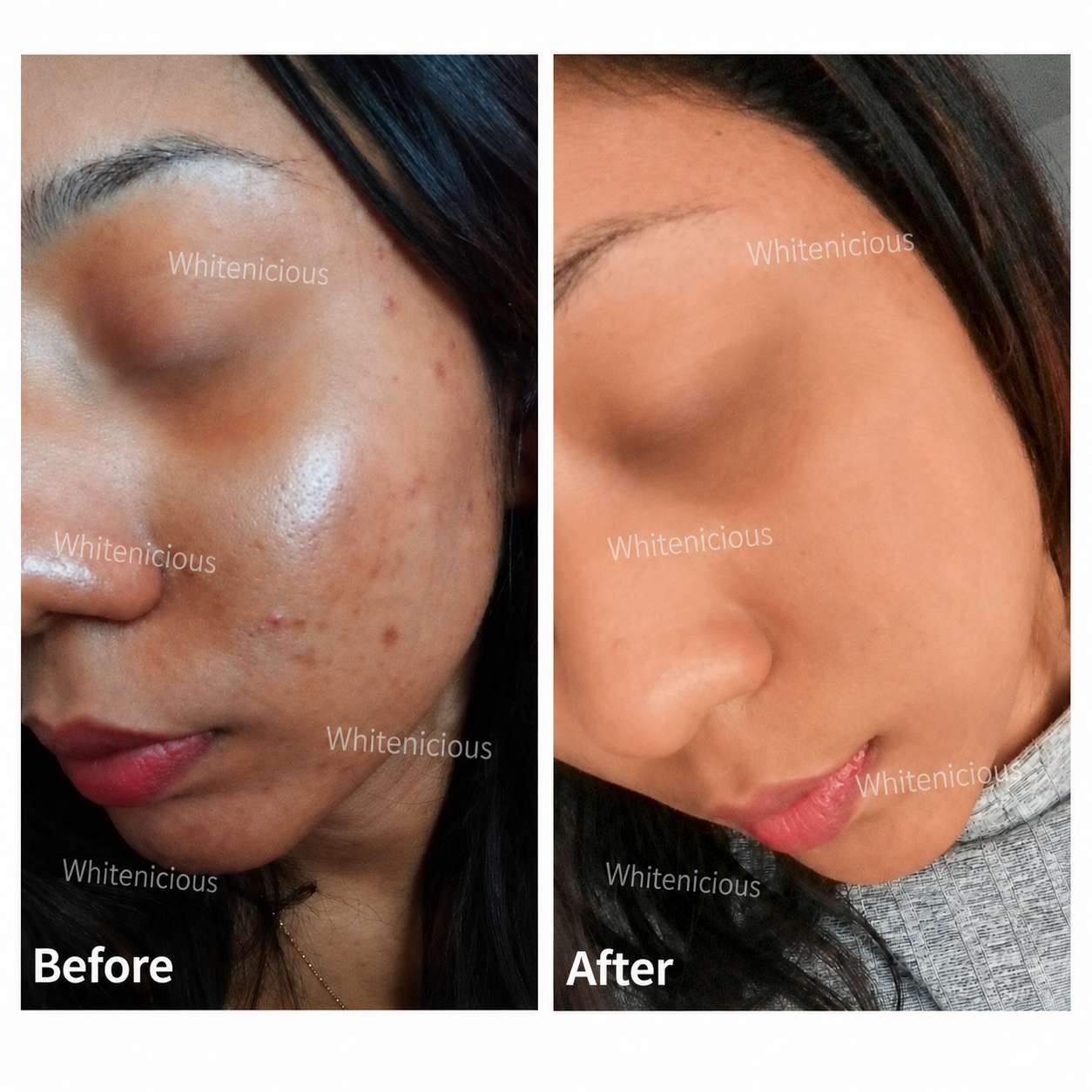 Angel Skin Creme